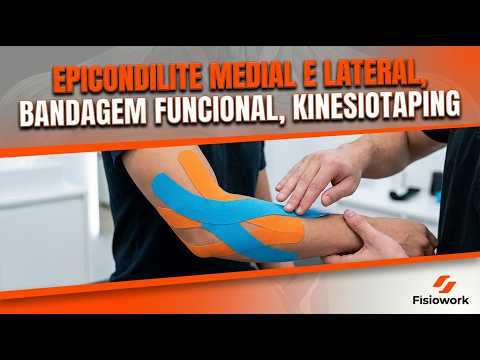 Vídeo: Como colocar kinesio no ombro: perguntas comuns