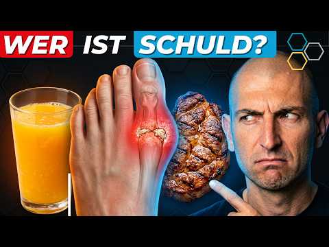 Vorschau Video: Gicht und Harnsäure