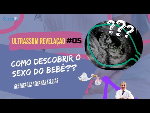 OBSTETRIC ULTRASOUND 12 weeks - How to find out the sex of the baby? Gender Reveal LIVE #05