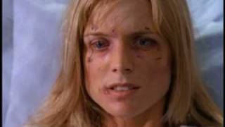 Melrose Place - Eye Damage
