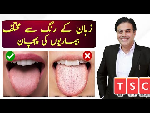 Zuban se bimari ka ilaj - Tongue reading for health