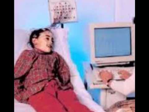 electroencefalograma