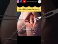 Shoulder Injury Shorts Doctor