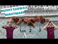 Deep Ear Wax Removal Compilation Microsuction Irrigation EP1169