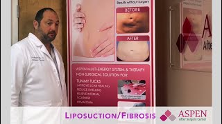 Liposuction Contour Irregularity / Stubborn Lipo Lumps and Bumps Treatment