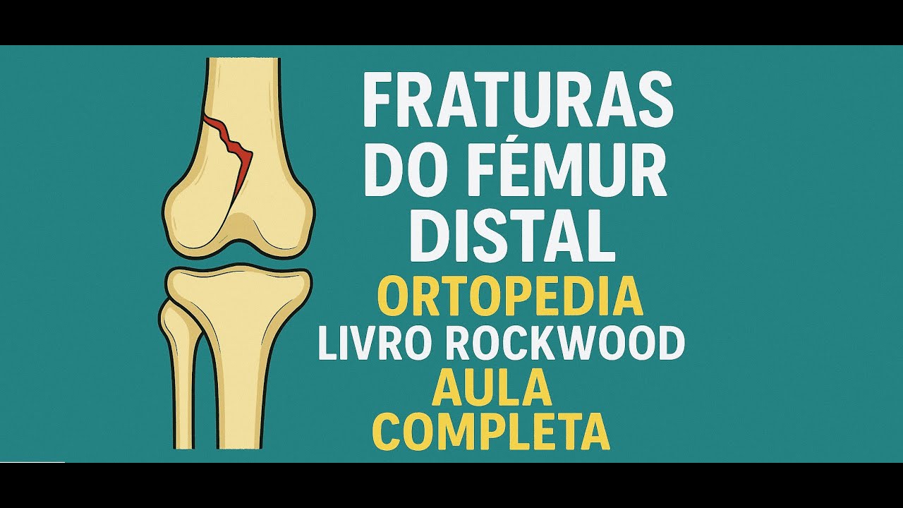 Fraturas do Fêmur Distal – Ortopedia – Rockwood