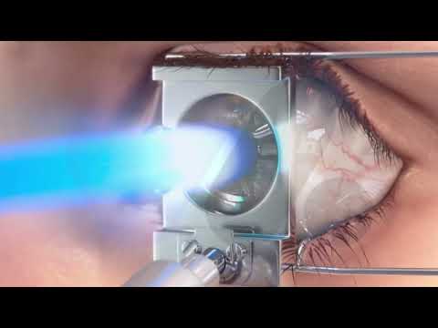 Legal Graphics Animation