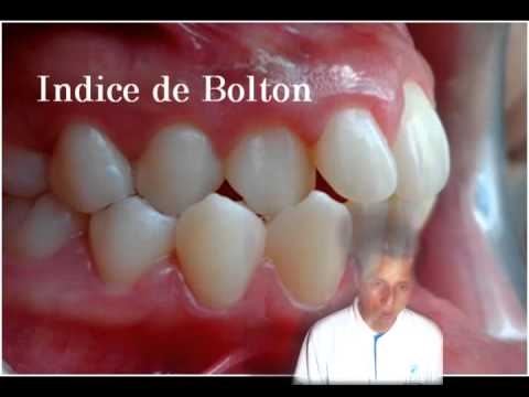 download lagu mp3 mp4 Analisis De Nance, download lagu Analisis De Nance gratis, unduh video klip Analisis De Nance