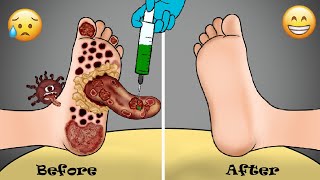 The monster in the foot ASMR removal the tongue th