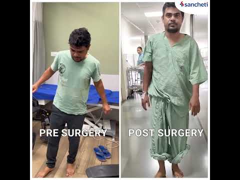 Lumbar Endoscopic Spine Surgery: Game changer