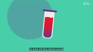 CA125 blood test for ovarian cancer