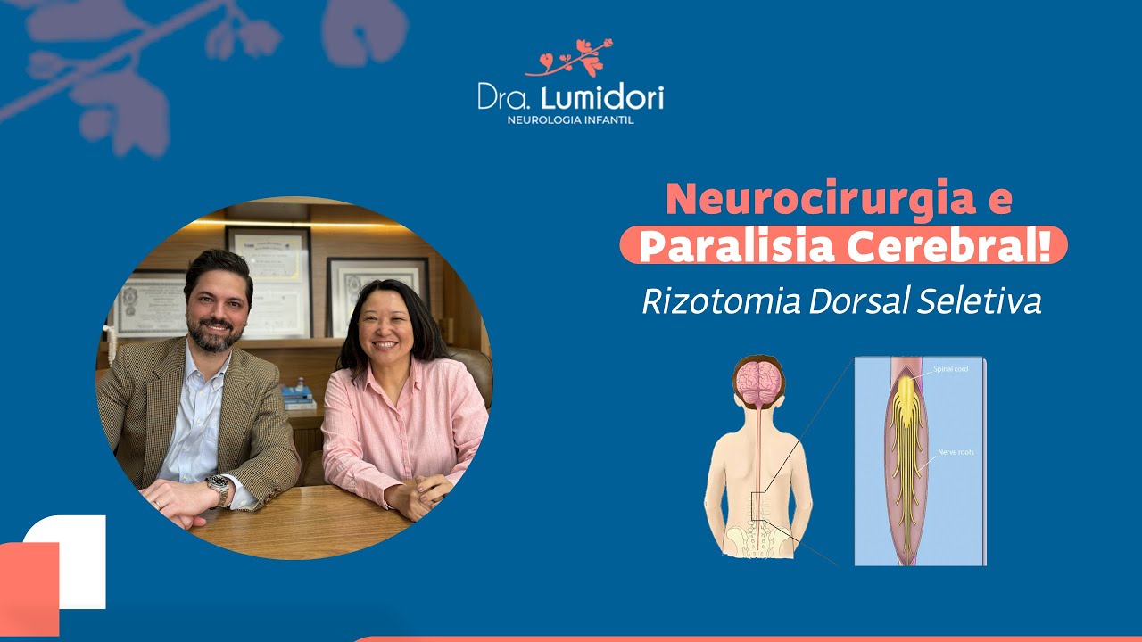 Série Neurocirurgia e Paralisia Cerebral: Rizotomia Dorsal Seletiva | Dra. Luciana Midori