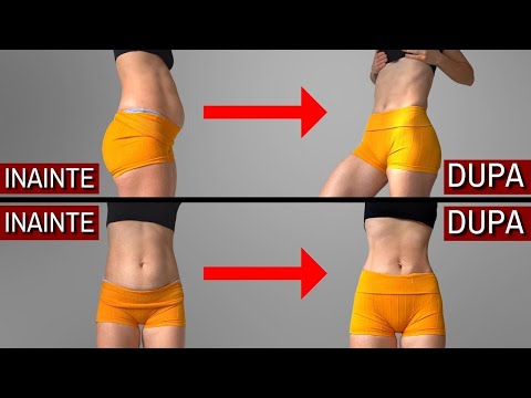 GET RID OF YOUR PREGNANCY BAG WITH THESE HOME EXERCISES (10 MINUTES A DAY)