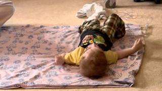 Lane, diagnosed with Full Trisomy 18, can now roll on the floor all by himself @ 35 months old.