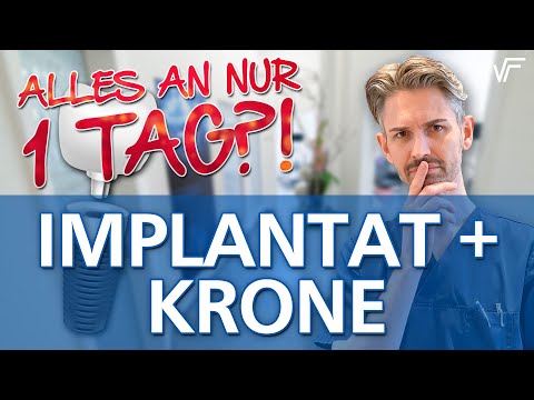 Nur 1 Tag: Implantat setzen und mit Krone versorgen - Ist das machbar?