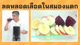 สูตรน้ำผักผลไม้สกัดเย็นช่วยลดเส้นเลือดในสมอง แตก และ อุดตัน จากเครื่องสกัดน้ำผลไม้แยกกากชนิดสกัดเย็น Hurom H200 ใหม่