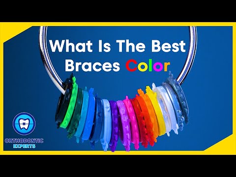 What are the BEST Braces Colors? | Braces Color Ideas