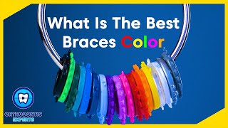 What are the BEST Braces Colors | Braces Color Ideas