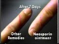 Neosporin Faster Healing 1987