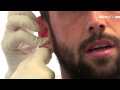 RSCAtv : medical tests Steven Defour