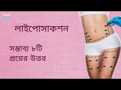 লাইপোসাকশন - ৮টি প্রায়শই জিজ্ঞাসিত প্রশ্ন