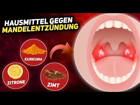 , title : '6 Natürliche Hausmittel gegen Mandelentzündung'