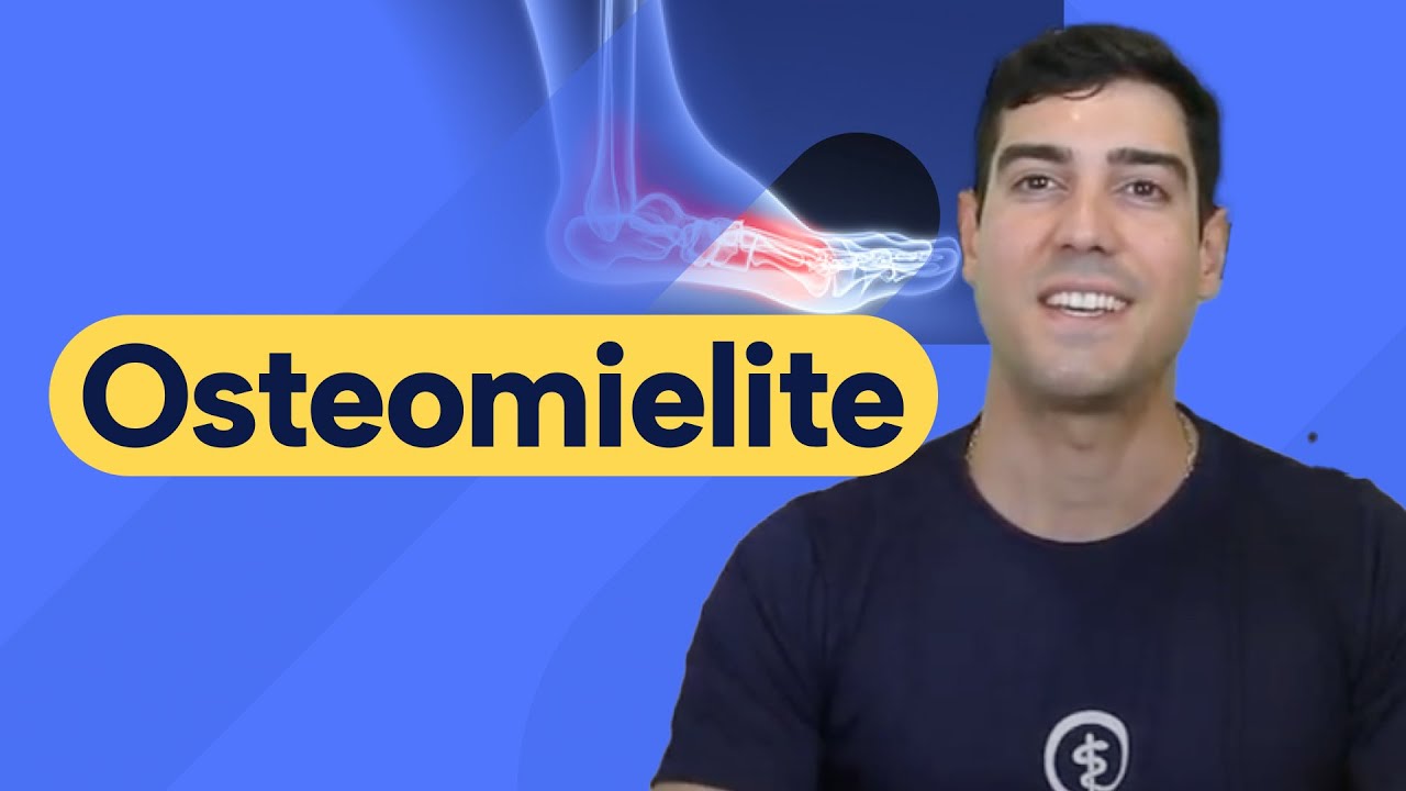 Osteomielite: causas, sintomas e diagóstico #medicina #ortopedia