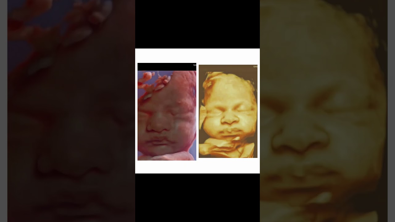 Fotos de Ultrassom 4D em 8k