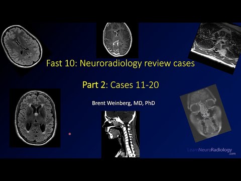 Fast 10: Neuroradiology high speed case review Part 2 - Cases 11-20