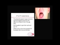 Neurology Topic 5g Cranial Nerve 9 10 With Notes