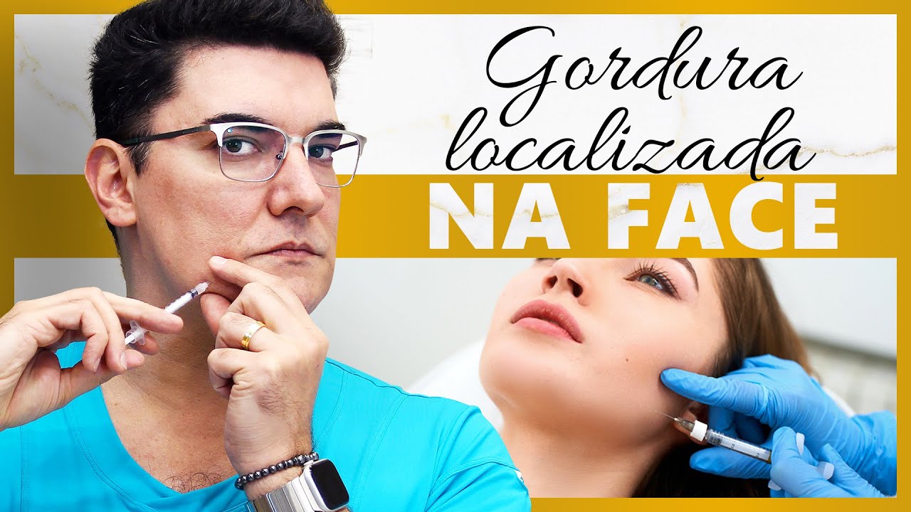 Gordura Localizada na Face | Tem tratamento? O que fazer?