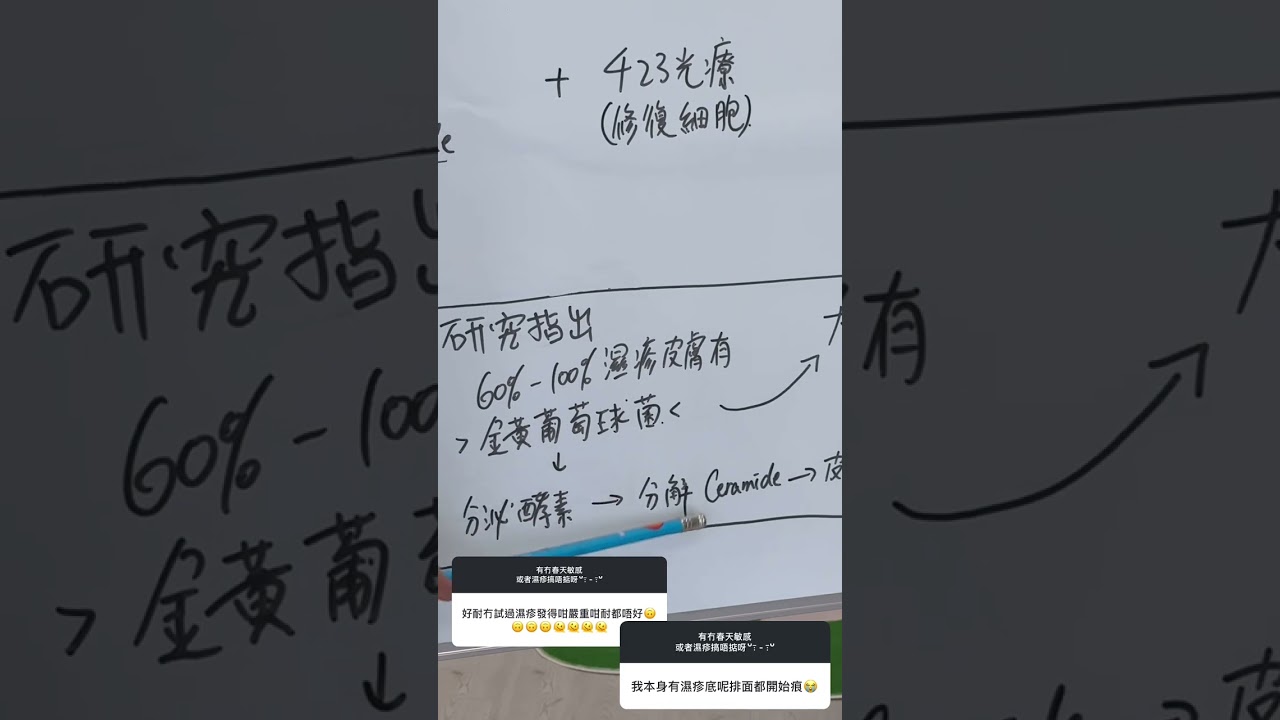 濕疹成因