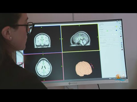 Transcranial magnetic stimulation therapy offers relief for some suffering from mental health woes