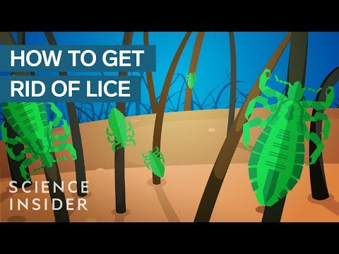 Why Lice Are So Hard To Kill Video