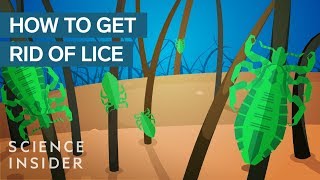 Why Lice Are So Hard To Kill