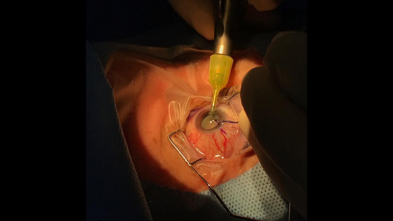 Raphael Montesinos-16