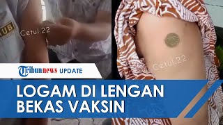 Download lagu Viral Video Uang Logam Disebut Bisa Menempel di Lengan Bekas Suntikan Vaksin Covid-19, Ini Faktanya mp3 Download lagu Viral Video Uang Logam Disebut Bisa Menempel di Lengan Bekas Suntikan Vaksin Covid-19, Ini Faktanya mp3