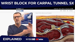 Wrist Block For Carpal Tunnel Sx - Crash course with Dr. Hadzic