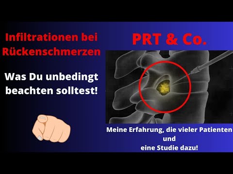 Infiltration gereizter Nerven (PRT & Co) nach einem BSV! Sinnvoll?Meine Erfahrung als Schmerzpatient