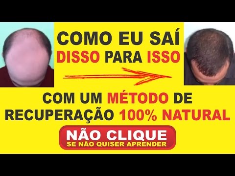 calvice herança genetica