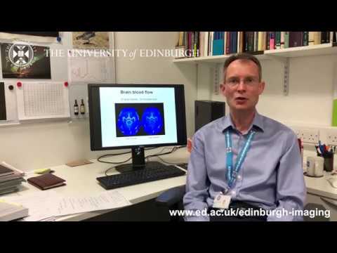 Professor Ian Marshall, Edinburgh Imaging