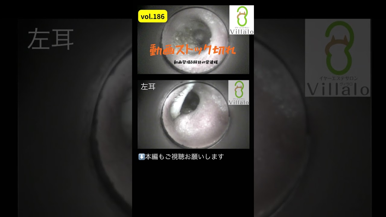 耳掃除 vol.186 #shorts #耳掃除#イヤーエステサロンVillalo