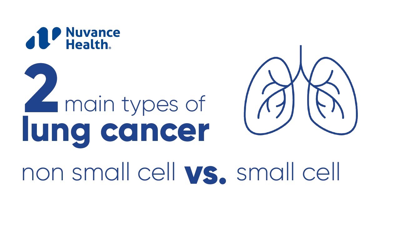 What Are the Two Types of Lung Cancer? Small Cell vs. Non-Small Cell
