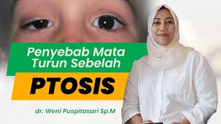 KELOPAK MATA TURUN SEBELAH PENYEBAB MATA MALAS ( PTOSIS ) - VIO OPTICAL CLINIC