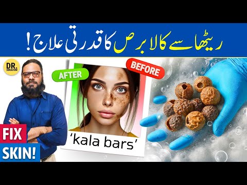 Reetha Ke Fayde/Istemal | Soap Nuts, Soapberry Benefits | Kala Bars | Dr. Ibrahim