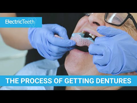 The stages of getting a denture & false teeth