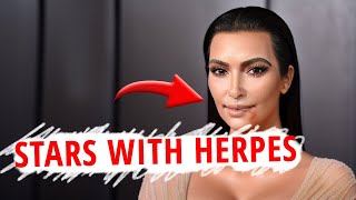 10 Celebrities Hiding Their HERPES!