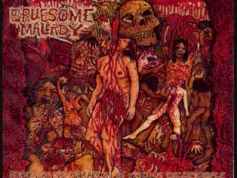 Gruesome Malady - Crypts Of Ichor (intro)