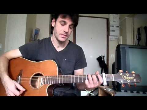 Anomalie - Louise Attaque
