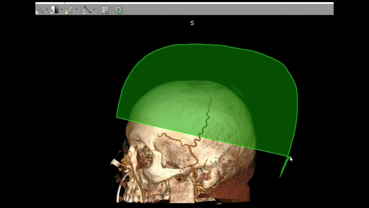 David Tafur Muñoz-2453